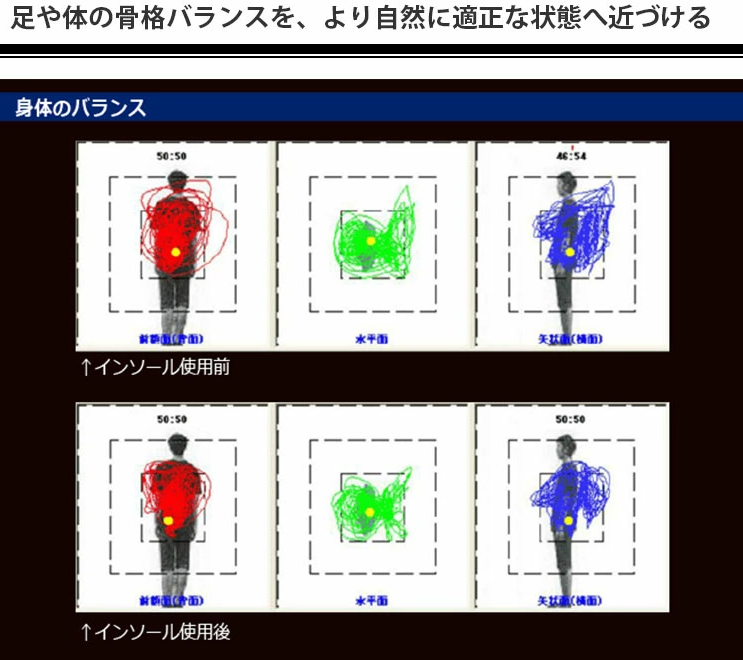 足が速くなった!腰の痛みが和らいだ!?BMZインソール「スタンダード」ウォーキングなどにおすすめ! 特許を取得した立方骨(cuboid)理論