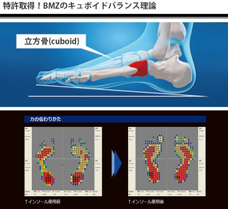 足が速くなった!腰の痛みが和らいだ!?BMZインソール「スタンダード」ウォーキングなどにおすすめ! 特許を取得した立方骨(cuboid)理論